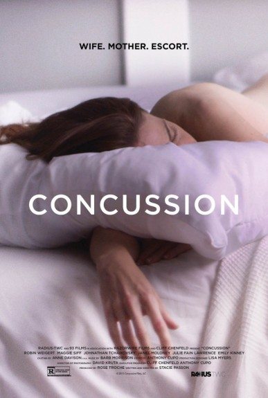  - Concussion