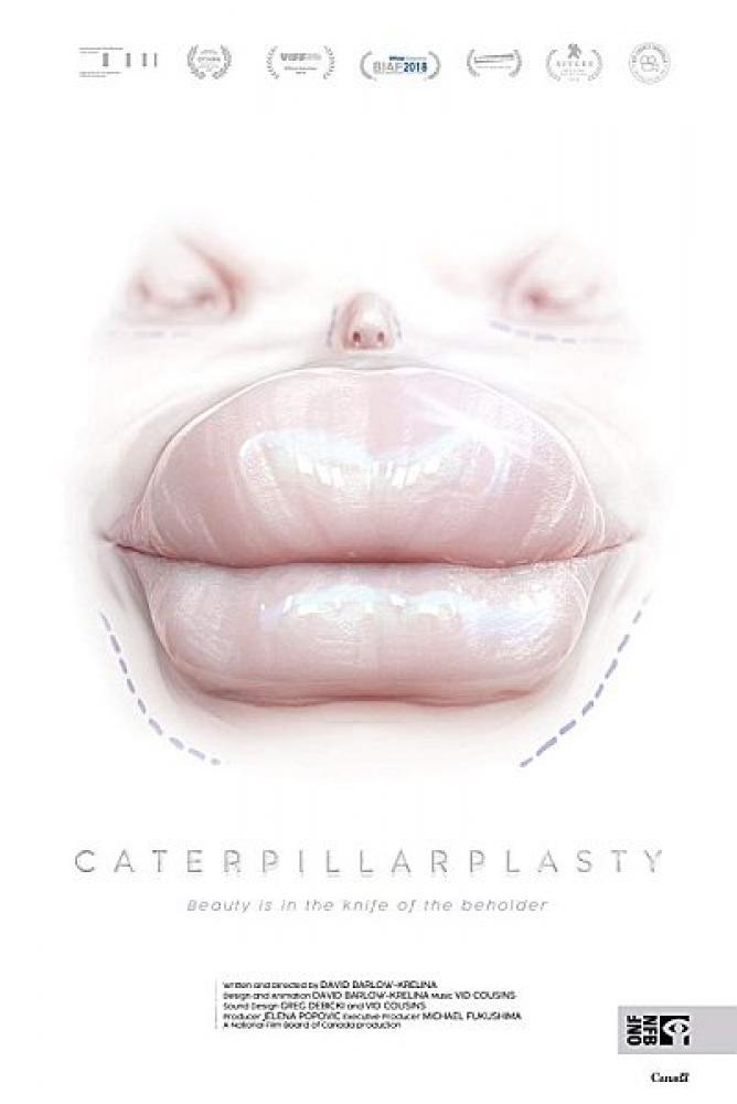 Папиллиопластика - Caterpillarplasty