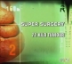 Discovery: Радикальная хирургия. Опухоль весом 72 килограмма - (Super Surgery. 72 Kilo Tumour)