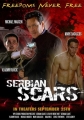 Шрам Сербии - (Serbian Scars)